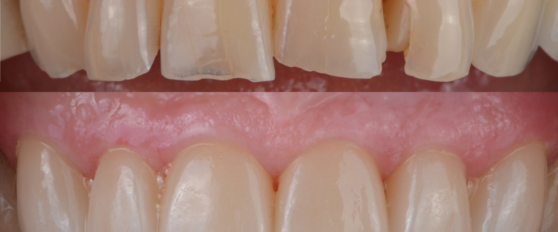 Revealed: What Makes the Best Cosmetic Dentist in San Diego Stand Out?